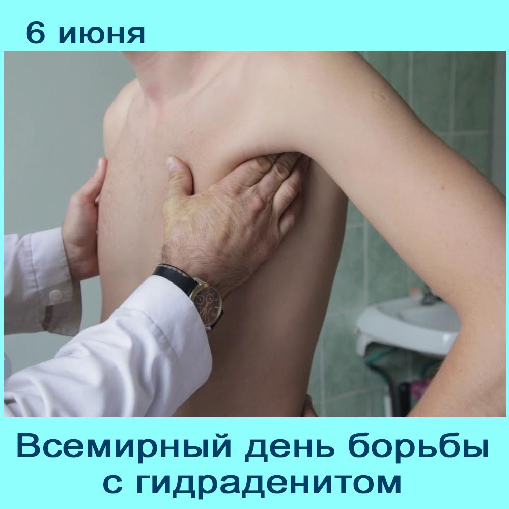 какой врач проверяет лимфоузлы