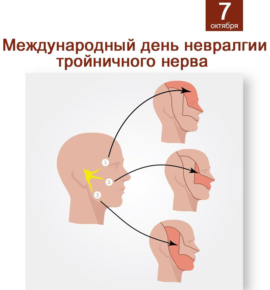 Воспаление нерва что делать. Невралгия тройничного нерва. Невралгия лицевого нерва. Воспаление тройничного нерва на лице.